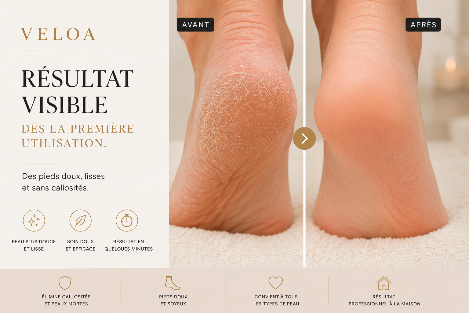 VELOA Pro – Lime Électrique Pieds Doux